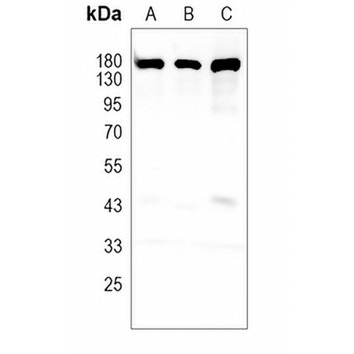 CD31 Rabbit Monoclonal Antibody(C673)