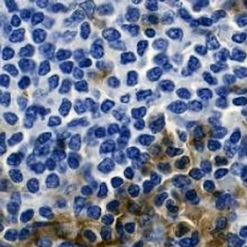CD33 Rabbit Monoclonal Antibody(C674)