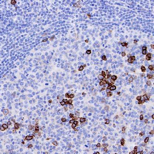 CD38 Rabbit Monoclonal Antibody(C676)