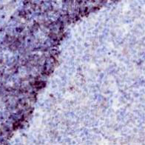 CD79b Rabbit Monoclonal Antibody(C683)