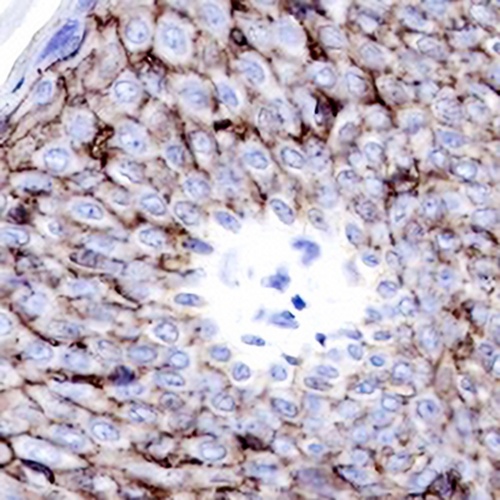 Claudin 1 Rabbit Monoclonal Antibody(C687)