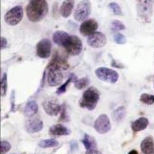 PARP1 (Cleaved-D214) Rabbit Monoclonal Antibody(C688)