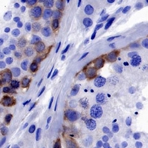 CTAG1B Rabbit Monoclonal Antibody(C690)