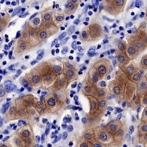 TNS4 Rabbit Monoclonal Antibody(C691)