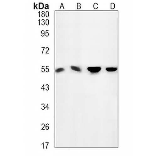 Desmin Rabbit Monoclonal Antibody(C693)