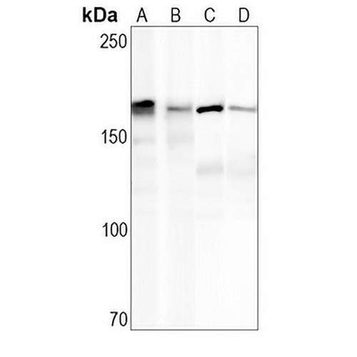 EGFR Rabbit Monoclonal Antibody(C694)