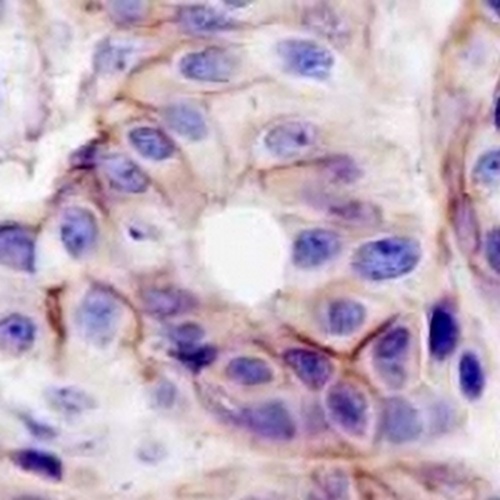 EPHA2 Rabbit Monoclonal Antibody(C695)
