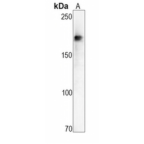 HER3 Rabbit Monoclonal Antibody(C696)