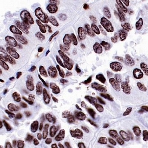 ERCC1 Rabbit Monoclonal Antibody(C697)
