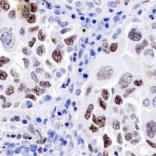 EZH2 Rabbit Monoclonal Antibody(C698)