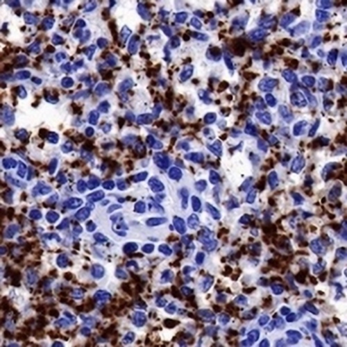 Factor XIIIa Rabbit Monoclonal Antibody(C699)