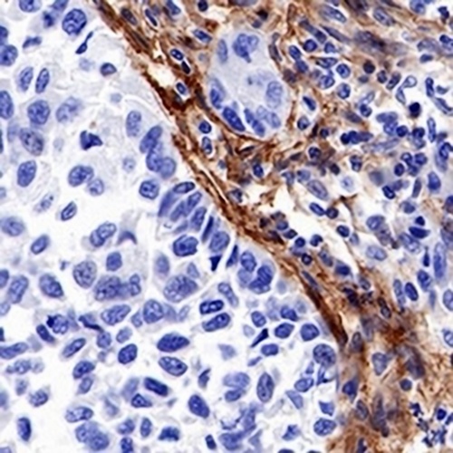 FAP alpha Rabbit Monoclonal Antibody(C700)