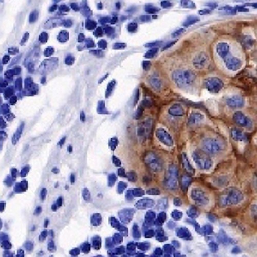 FGFR2 Rabbit Monoclonal Antibody(C702)