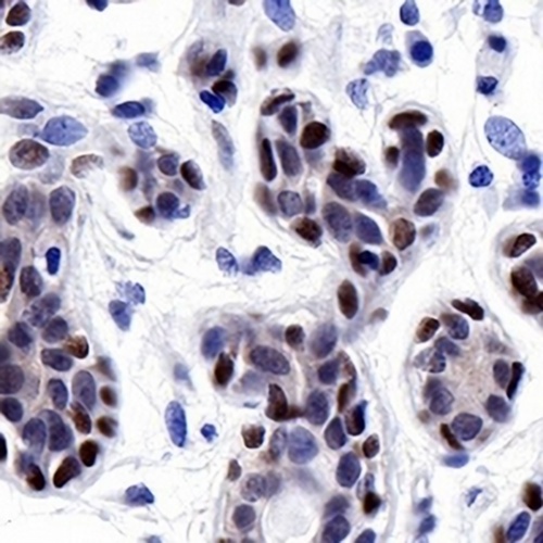 FOXP1 Rabbit Monoclonal Antibody(C703)