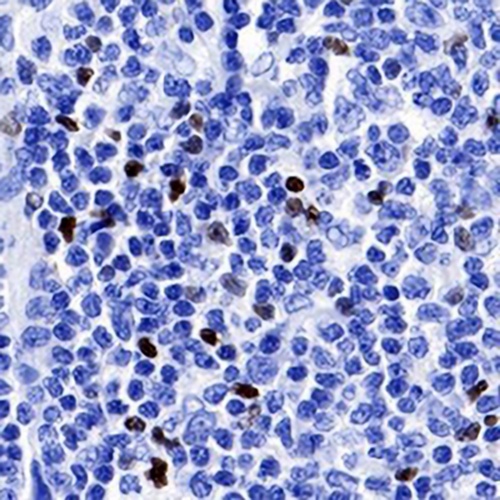 FOXP3 Rabbit Monoclonal Antibody(C704)