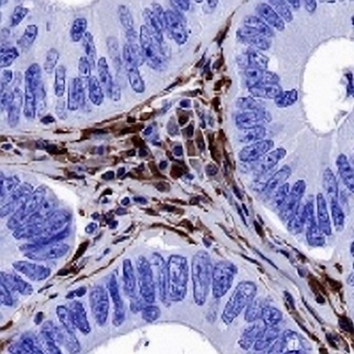 Galectin 1 Rabbit Monoclonal Antibody(C705)