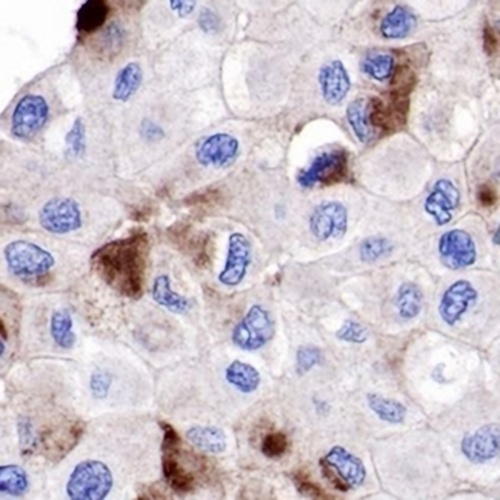 PIP Rabbit Monoclonal Antibody(C706)