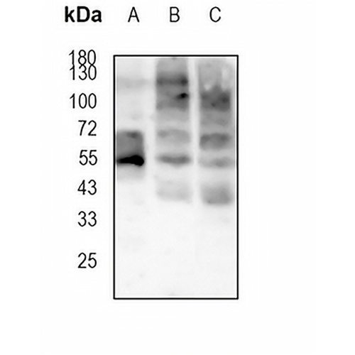 GLUT1 Rabbit Monoclonal Antibody(C707)