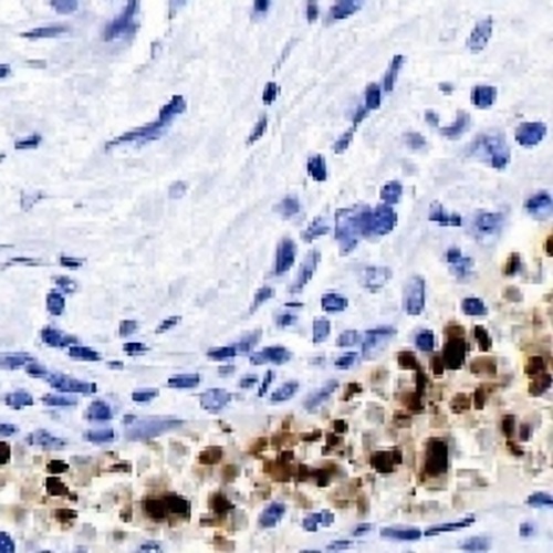 Hemoglobin alpha Rabbit Monoclonal Antibody(C708)