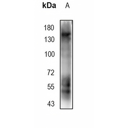 ENT1 Rabbit Monoclonal Antibody(C709)