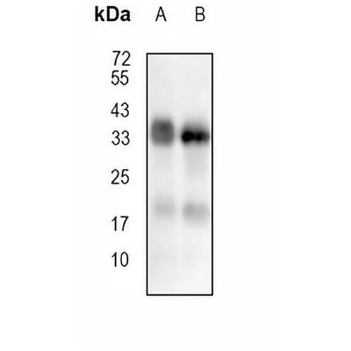 HLA-DP Rabbit Monoclonal Antibody(C710)