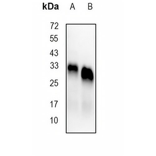 HLA-DPB1 Rabbit Monoclonal Antibody(C711)