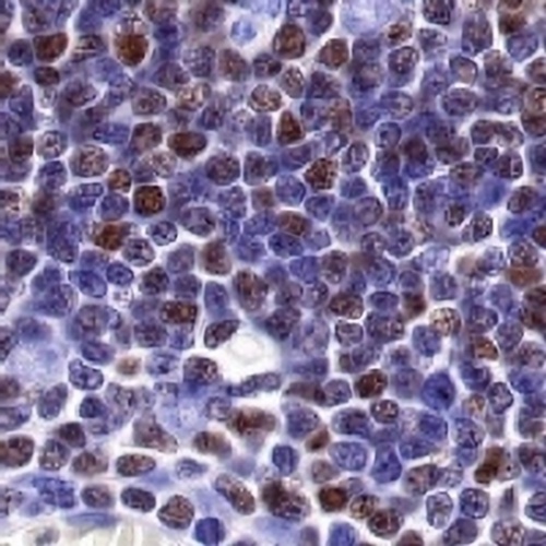 Ikaros Rabbit Monoclonal Antibody(C713)
