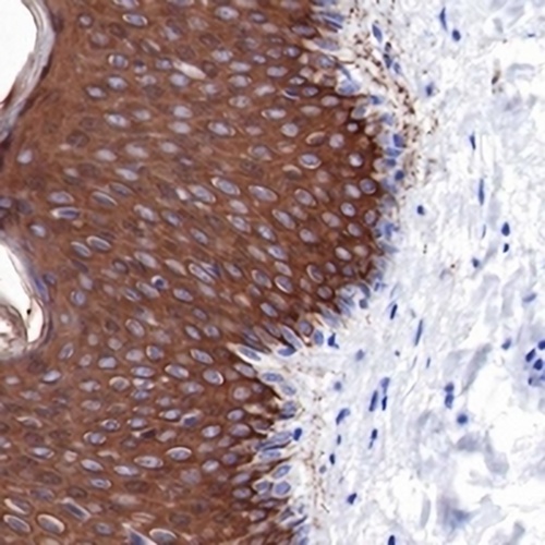 Cytokeratin 10 Rabbit Monoclonal Antibody(C716)