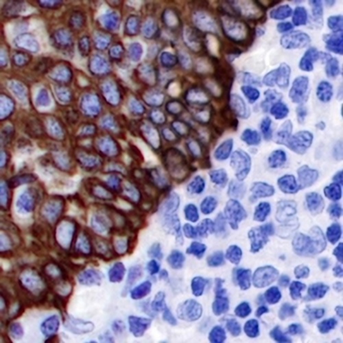 Cytokeratin 14 Rabbit Monoclonal Antibody(C717)
