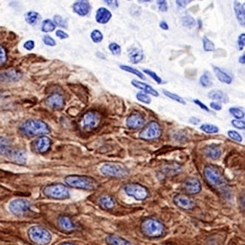 Cytokeratin 17 Rabbit Monoclonal Antibody(C718)