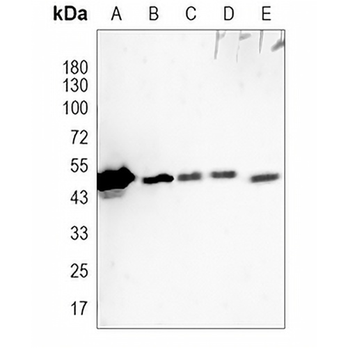 Cytokeratin 20 Rabbit Monoclonal Antibody(C719)