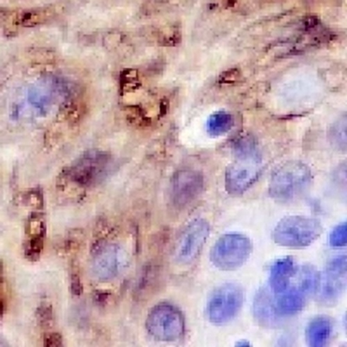 Cytokeratin 4 Rabbit Monoclonal Antibody(C720)
