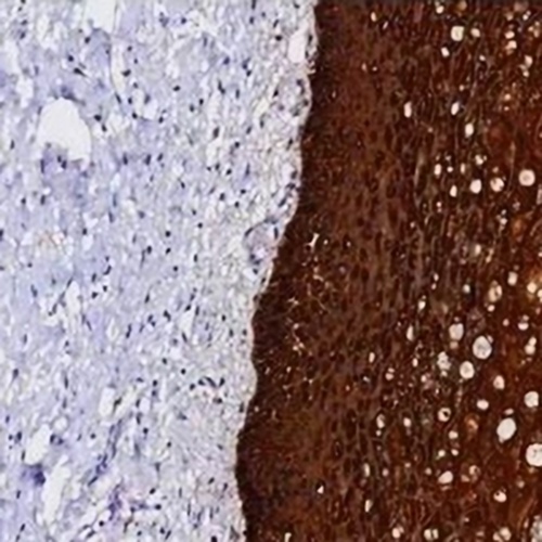 Cytokeratin 5 Rabbit Monoclonal Antibody(C721)