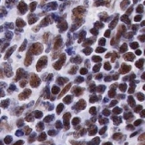 Ku80 Rabbit Monoclonal Antibody(C722)
