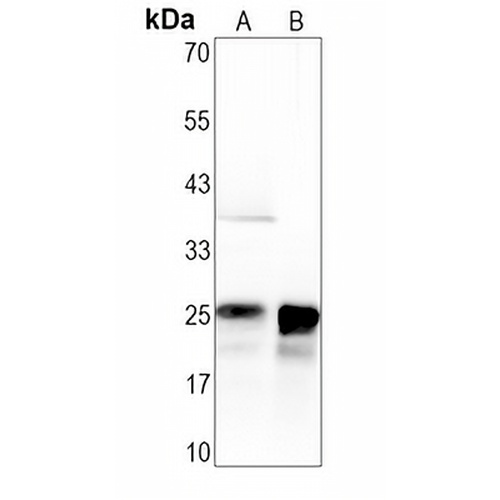 Lambda Light Chain Rabbit Monoclonal Antibody(C723)