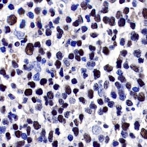 LMO2 Rabbit Monoclonal Antibody(C724)