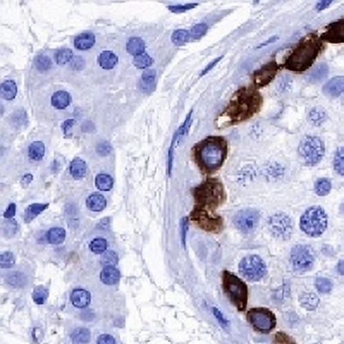 MAGEA1 Rabbit Monoclonal Antibody(C725)