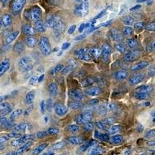 Mesothelin Rabbit Monoclonal Antibody(C726)