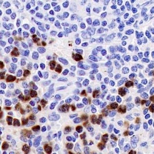 Myeloperoxidase Rabbit Monoclonal Antibody(C729)