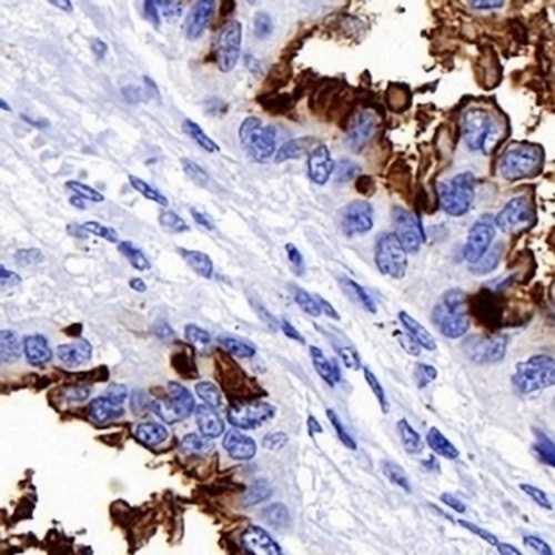 NaPi-2b Rabbit Monoclonal Antibody(C730)
