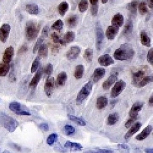 Nucleophosmin Rabbit Monoclonal Antibody(C733)
