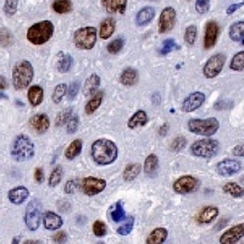 p14 ARF Rabbit Monoclonal Antibody(C734)
