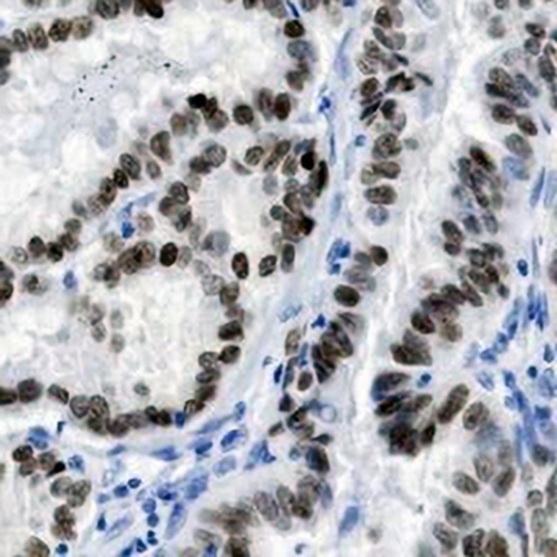 PAX8 Rabbit Monoclonal Antibody(C736)