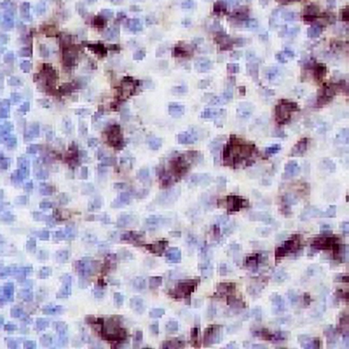 CD279 Rabbit Monoclonal Antibody(C737)
