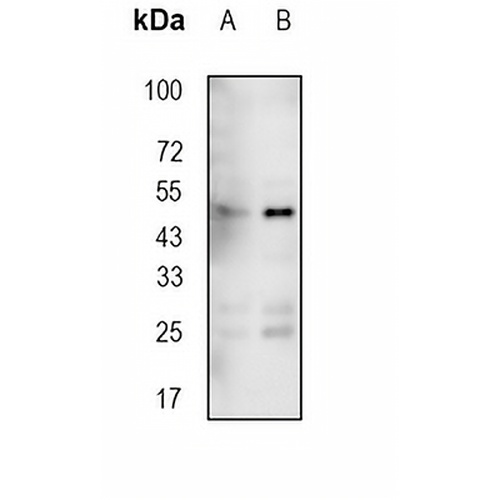 PDK1 Rabbit Monoclonal Antibody(C738)