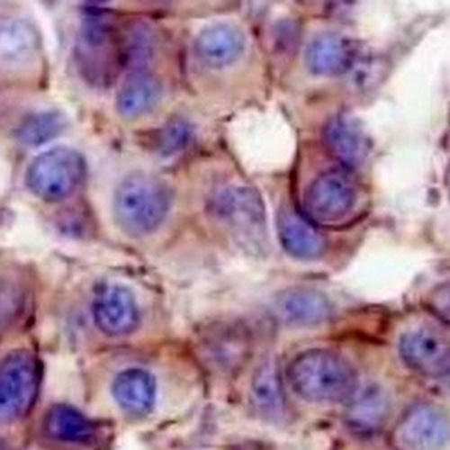 PI3K p110 alpha Rabbit Monoclonal Antibody(C740)