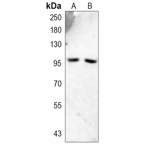 Progesterone Receptor Rabbit Monoclonal Antibody(C741)