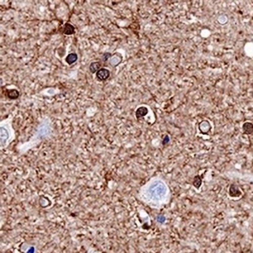 S100-B Rabbit Monoclonal Antibody(C744)