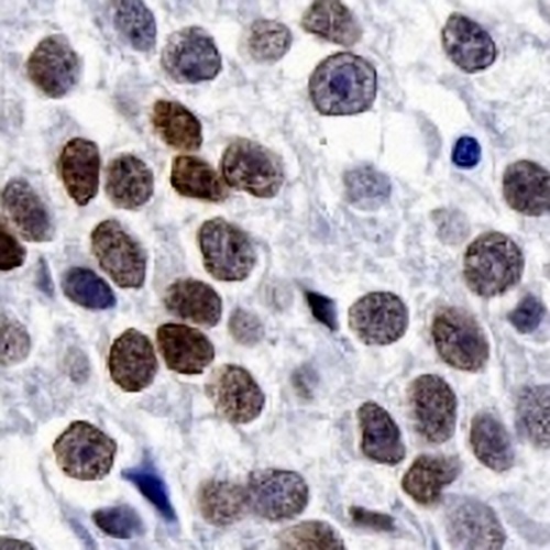 SALL4 Rabbit Monoclonal Antibody(C745)
