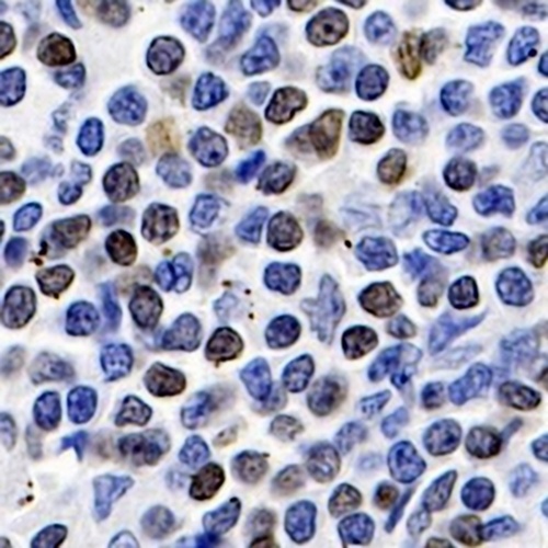 SATB1 Rabbit Monoclonal Antibody(C746)